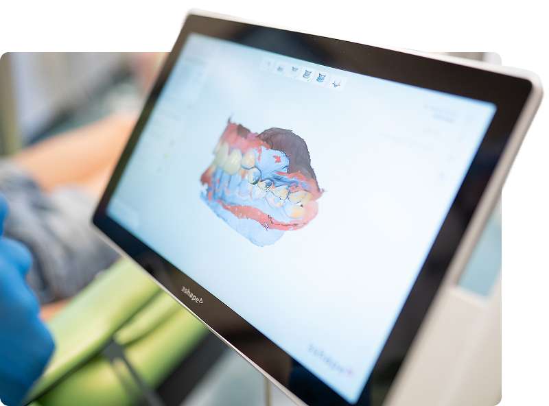 Monitor con scansione digitale 3D dentale presso il Centro di Odontoiatria e Stomatologia F. Perrini a Pistoia